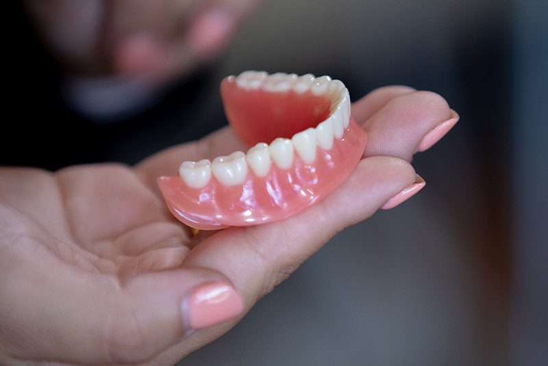 Implant supported dentures