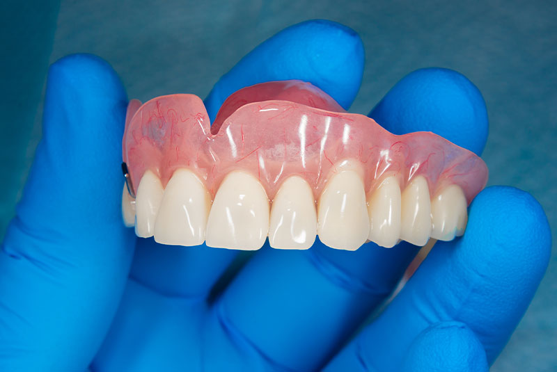 complete denture