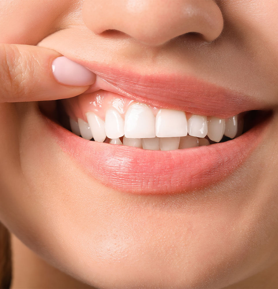 dental patient showing healthy gums