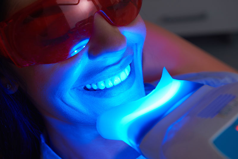 professional teeth whitening patient